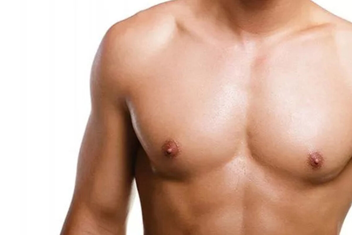 Gynecomastia Removal