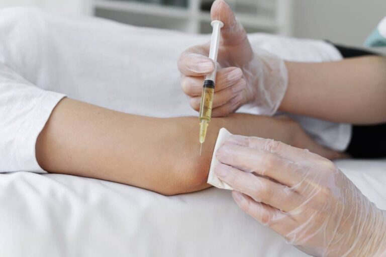 User Guide On P Shot Treatment