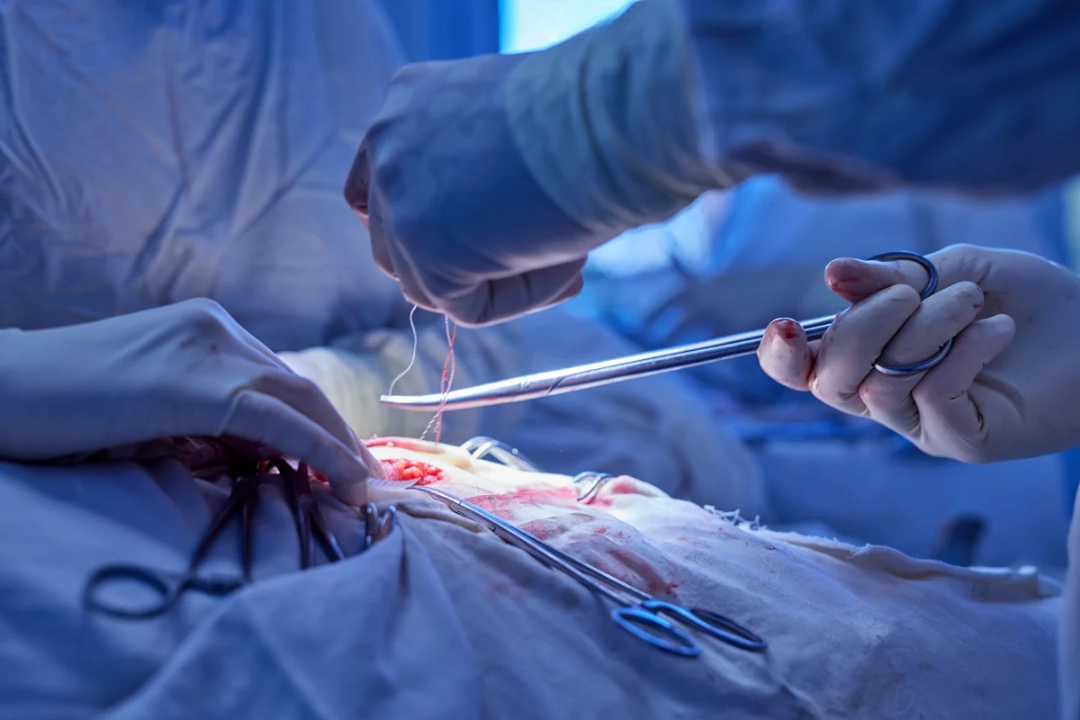 Gynecomastia Specialist Doctor